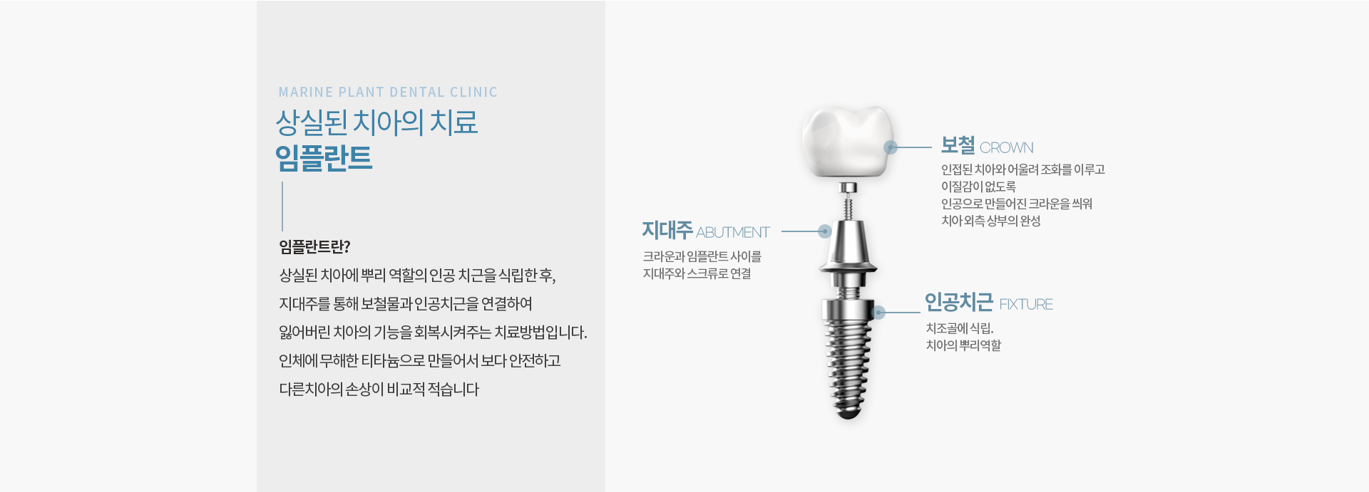 마린플란트 임플란트